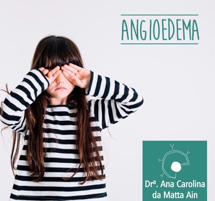 Angioedema: causas e tratamento, dicas da alergista Ana Carolina da Matta Ain